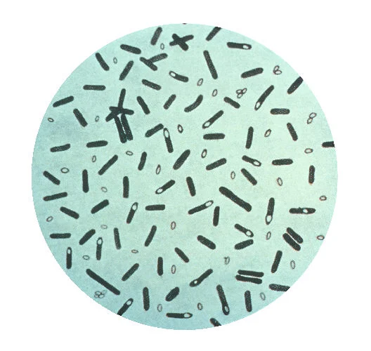 A photomicrograph of Clostridium botulinum bacteria.
This is an illustration of a photomicrograph of Clostridium botulinum stained with Gentian violet. The bacterium C. botulinum produces a nerve toxin, which causes the rare, but serious paralytic illness Botulism.